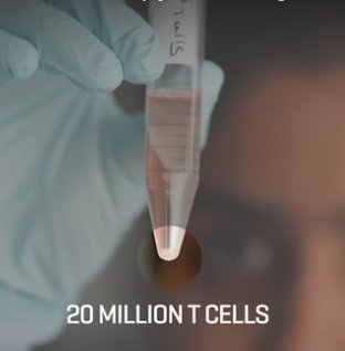 A single treatment of a relatively small number of the re-engineered T cells only takes about 30 minutes, and within weeks, the patient goes into a complete remission. (credit: Fred Hutchinson Cancer Research Center)