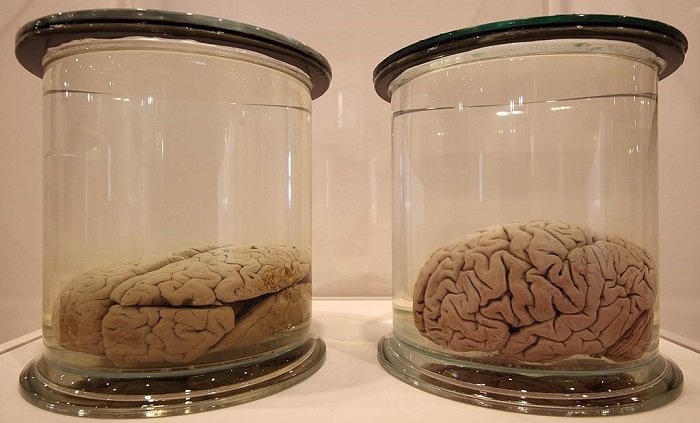 Brain on sugar
