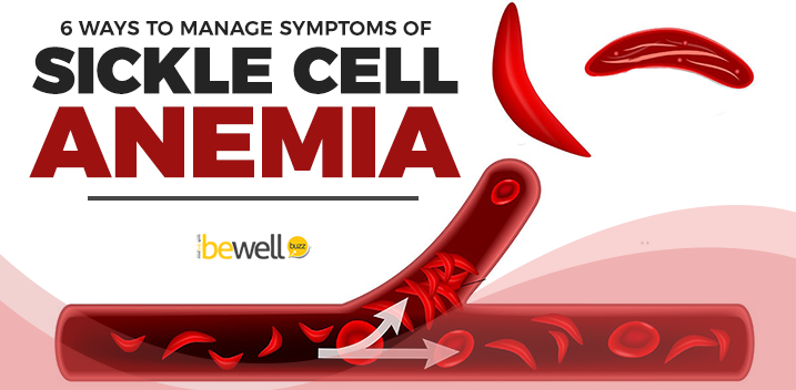 Natural Ways To Manage Symptoms Of Sickle Cell Anemia BeWellBuzz