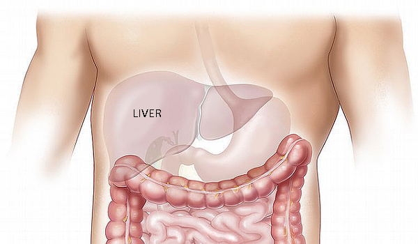 Liver cancer is also called hepatic cancer.